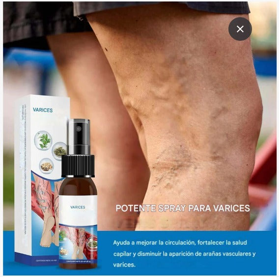 ¡Dile adiós a las venas varicosas y recupera tu bienestar! PROMO PAGA 1 LLEVA 2