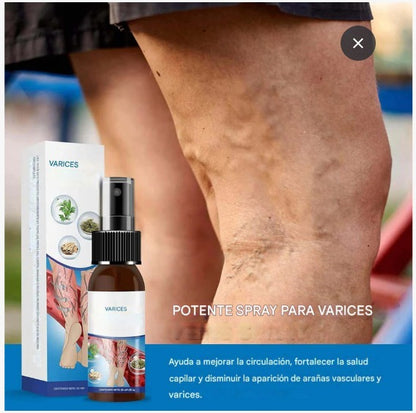 ¡Dile adiós a las venas varicosas y recupera tu bienestar!  PROMO PAGA 1 LLEVA 2