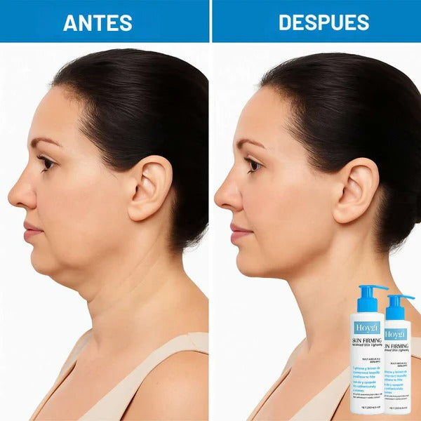 Reafirma tu piel y recupera la confianza sin cirugía