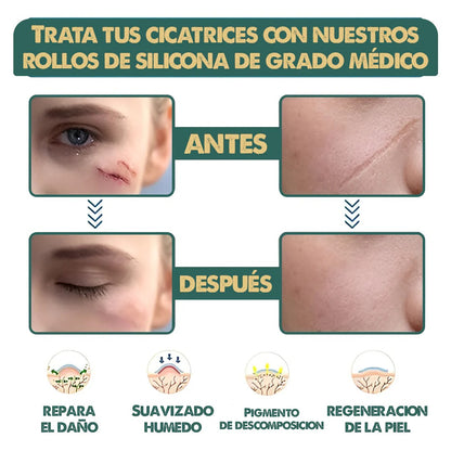 🩹 Dile adiós a las cicatrices y recupera la confianza en tu piel