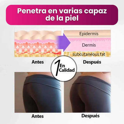 🍑 Levanta y Moldea tus Glúteos Naturalmente 2*1 COL