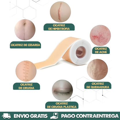 🩹 Dile adiós a las cicatrices y recupera la confianza en tu piel